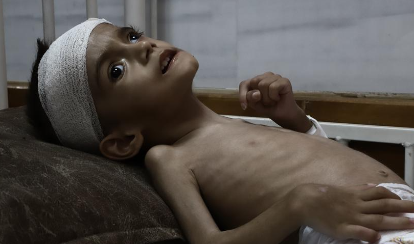 100 Lebih Bayi Prematur di Gaza Terancam karena Rumah Sakit Kehabisan Bahan Bakar